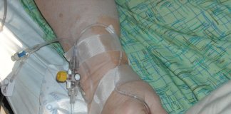 Linia naczyniowa a kultura bezpieczeństwa – jak standardy, szkolenia i dobór akcesoriów zmniejszają ryzyko błędów? bezpieczna linia naczyniowa 3.jpg