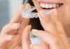 Na czym polega leczenie zębów systemem Invisalign? Najczęstsze pytania piotrowscybejnarowicz.pl - 004-na-czym-polega-leczenie-zebow-systemem-invisalign-najczestsz.webp